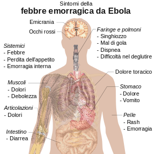 VIRUS EBOLA: la febbre emorragica spiegata semplicemente