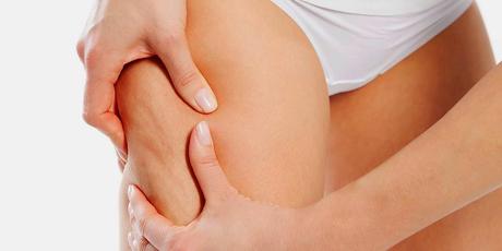 Cellulite: cocco e ananas all'attacco