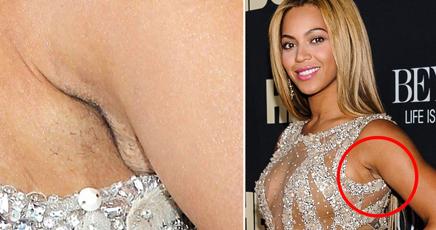 beyonce-depilazione-mancata