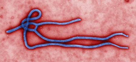 Ebola, un nuovo caso sospetto a Berlino
