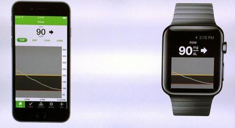 DexCom Apple Watch