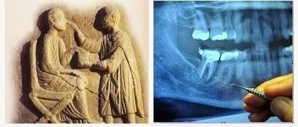 Il problema dei denti del giudizio