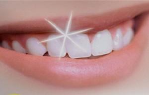 denti-bianchi