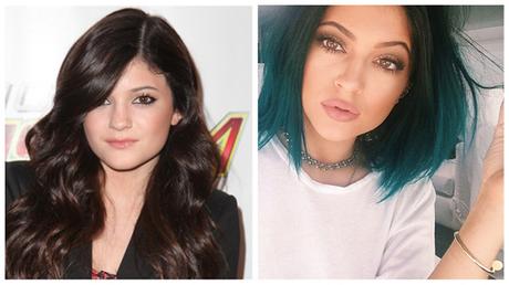 Kylie Jenner: chirurgia estetica