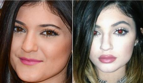Kylie Jenner: chirurgia estetica