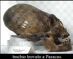Archeologia. Deformazioni craniche: antichi culti ?
