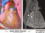 MILANO. buona sanità: funziona rete assistenza cittadini infarto miocardico