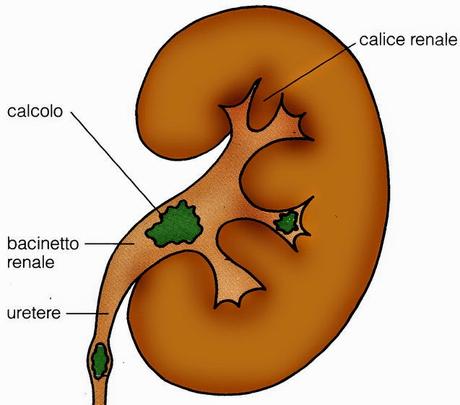 Un Decotto contro i Calcoli Renali e la Renella