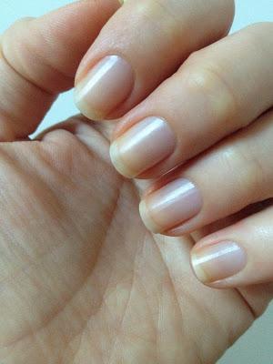 L'Oreal Nail Detox - risultati dopo 2 settimane