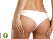 Rimedi naturali contro cellulite: efficaci!