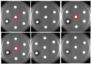 Gli Escherichia coli usati come fabbriche per produrre antibiotici più efficaci sui batteri resistenti