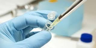 Test delle urine può rilevare il cancro al seno in fase iniziale Test delle urine può rilevare il cancro al seno in fase iniziale