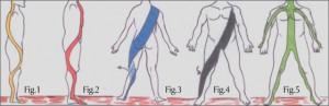 Le Catene Muscolari. Classificazione