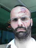 CASTELLO D’AGOGNA (pv). Stasera presidio per la sicurezza e solidarietà a Marco