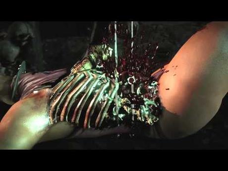 Immagine anteprima YouTube