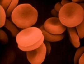 Anemia mediterranea: cosa è, sintomi e rischi