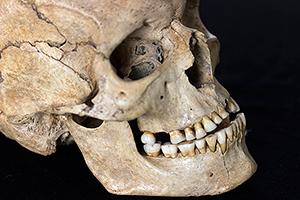 Dentisti...antidiluviani