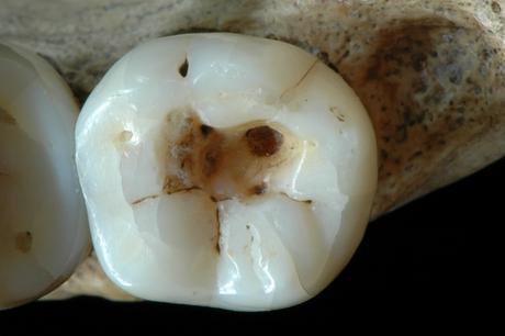 Dentisti...antidiluviani