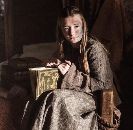 La principessa Shireen Baratheon, affetta da Morbo Grigio