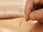 L'agopuntura aiuta abbassare pressione