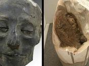 Nebiri, antico caso scompenso cardiaco