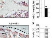 NELL-1 proteina stimola efficace formazione ossea