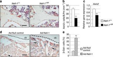 NELL-1 è la proteina che stimola un efficace formazione ossea