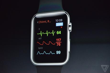 Apple: tutto ciò che c’è da sapere sull’iWatch