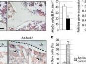 proteina NELL-1 potrà curare l’osteoporosi