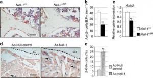 Gli stadi di evoluzione della proteina Nell-1 per curare l'osteoporosi