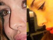 Belen Stefano Martino, ritocchini (plastici) coppia