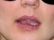 Katie Holmes senza denti
