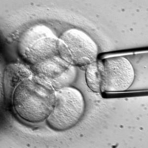 Nuove ricerche: le cellule staminale del midollo osseo sono sicure e efficaci