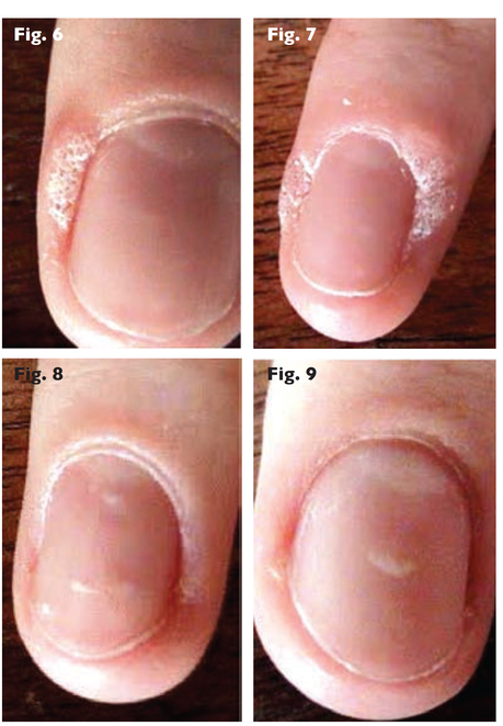 L'atteggiamento corporeo e mentale in omeopatia