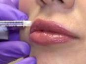 cure estetiche l'inchiesta Report sugli interventi estetici