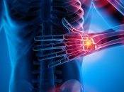 Artrosi fibromialgia: quando dolori nascono nella psiche