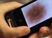 Ricercatori Federico inventano un’App diagnosticare melanoma