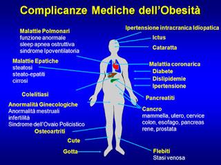 ROMA. Oltre 500 milioni gli obesi nel mondo: un nuovo farmaco anti obesità presentato al congresso di Pisa.