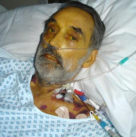 PAY-George-Best-in-hospital