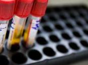 Record Aids Europa: 2014 142mila diagnosi Hiv. numero alto mai”