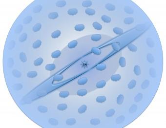 Schema del materiale circumstellare attorno alla supernova, come riportato dagli autori. Nella regione più interna il materiale presentava una forma oblata. I resti stellari espulsi nell'esplosione, interagendo con esso, danno origine alle righe larghe ed asimmetriche dell'idrogeno e dell'elio. Terminata questa fase, circa 150 giorni dopo l'€™esplosione, i resti espulsi incontrano altro materiale, disposto principalmente in un disco e in agglomerati. Queste tre componenti sono visibili per tutta la durata delle osservazioni, durate circa 15 anni