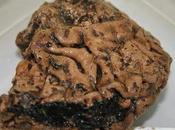 Scoperto cervello umano conservato vecchio 2.500 anni