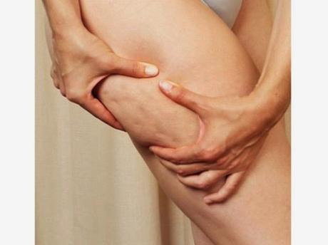 S.o.s ritenzione idrica