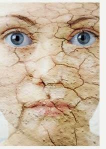 Pelle secca: metodi naturali per curarla