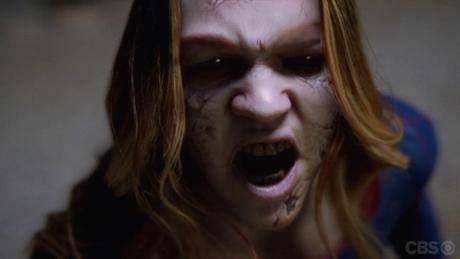 Recensione | Supergirl 1×12 ‘Bizarro’