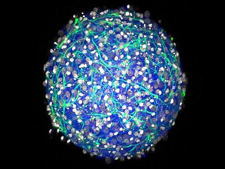 Mini cervelli in laboratorio: vivisezione a una svolta?