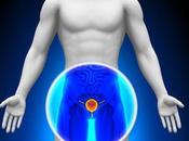 Prostatite: Sintomi Aspetti Psicologia Sociologia