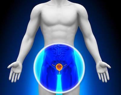 Prostatite: Sintomi e Aspetti di Psicologia e Sociologia