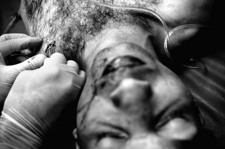 Un medico cuce una coltellata nel petto di William Sanjuanelo in un pronto soccorso di Petare, Venezuela.