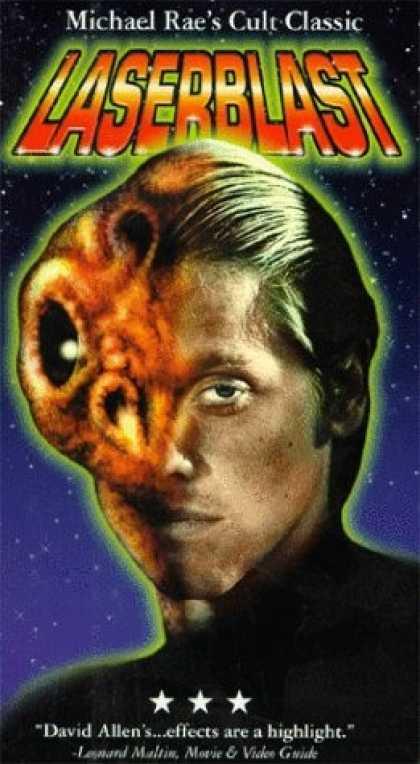 LASERBLAST (1978) di Michael Rae